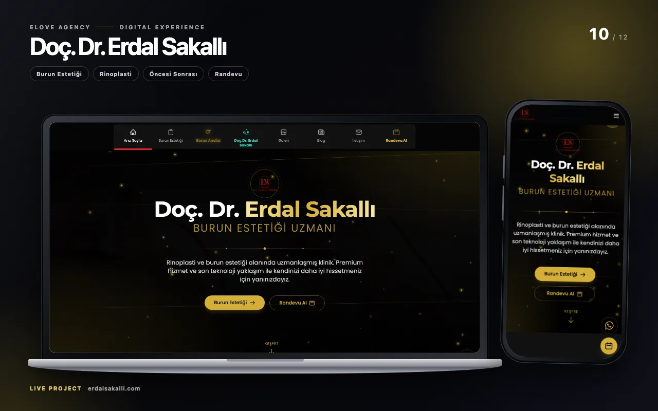 vanr. Dr. MacBook i iPhone pogled na sajt Erdal Sakallı; Oznake za estetiku nosa, rinoplastiku, pre posle i termin